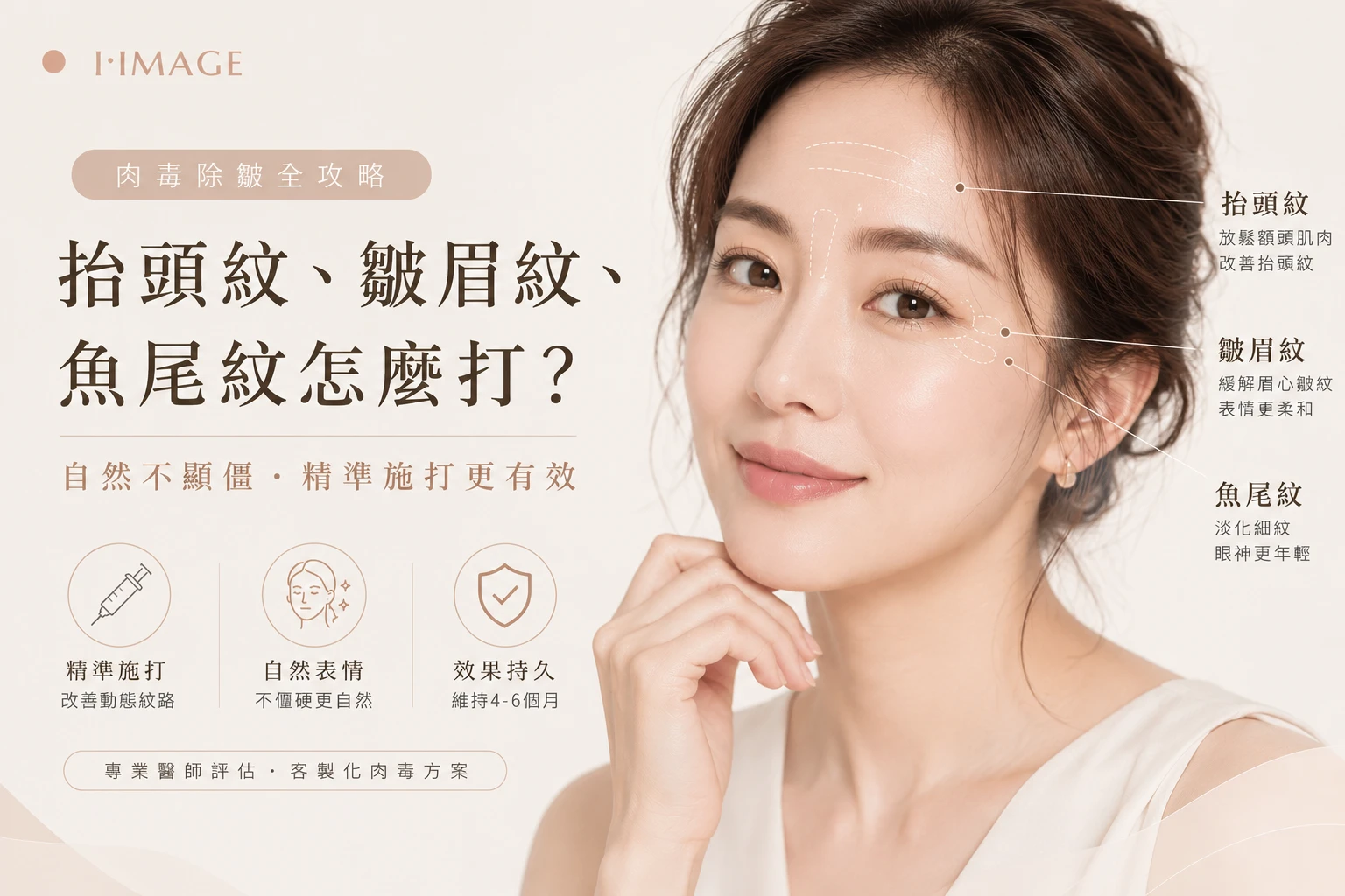 肉毒除皺抬頭紋皺眉紋魚尾紋-台中依美琦