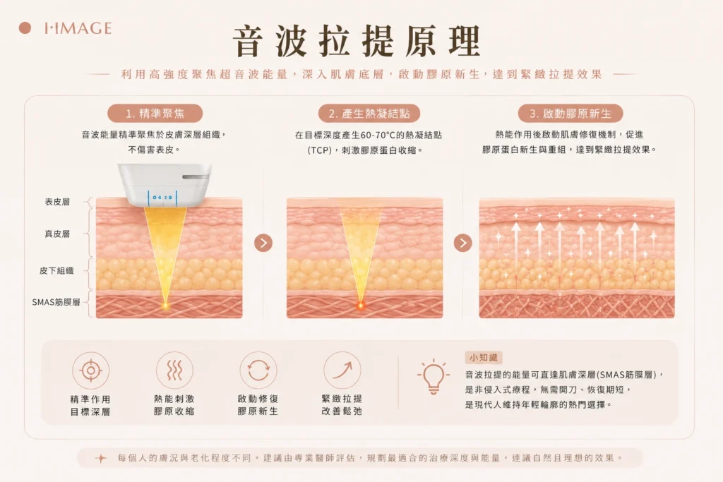 音波拉提聚焦超音波作用SMAS筋膜層拉提