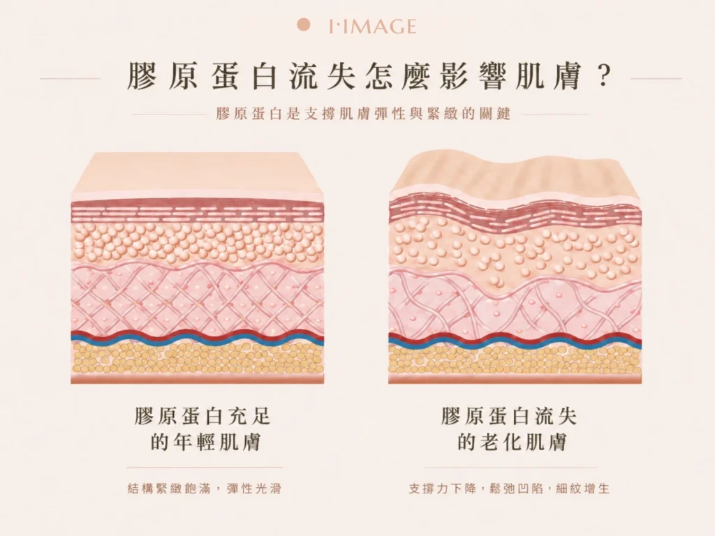 音波拉提 電波拉皮 差別在哪?原理是刺激膠原蛋白增生