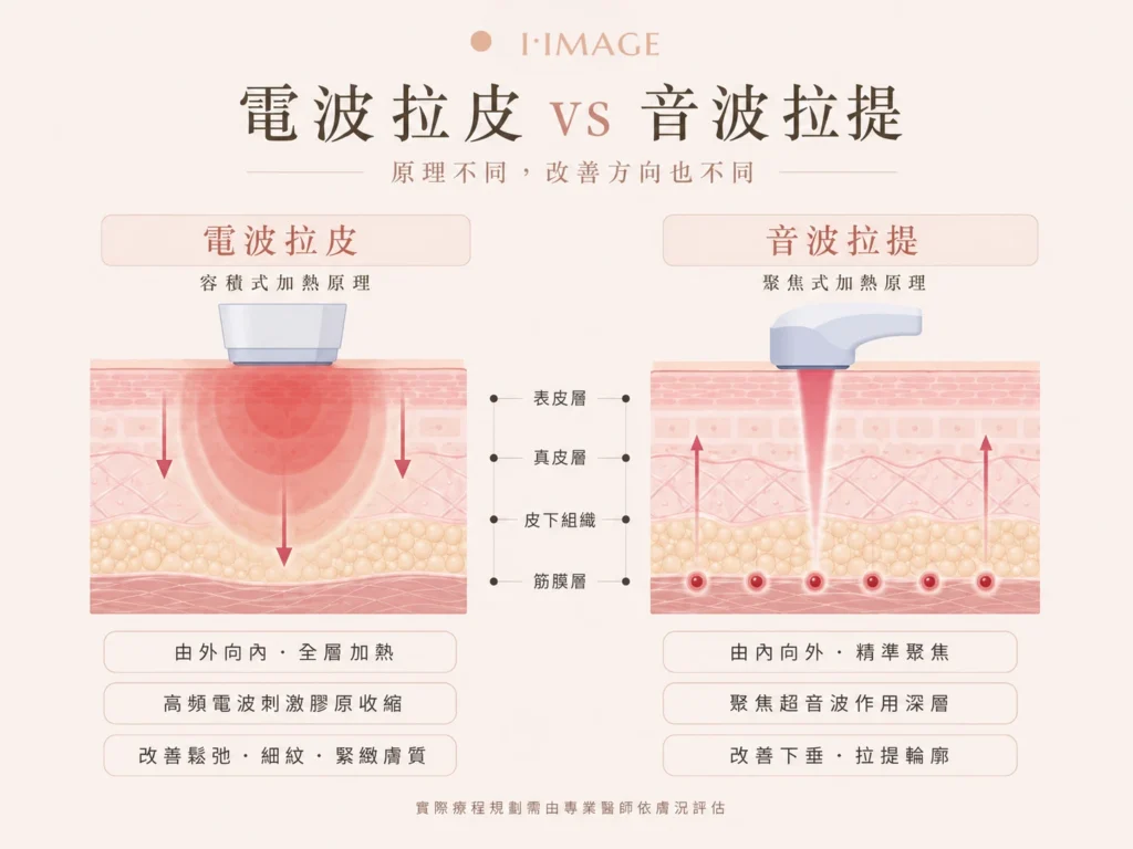 音波拉提電波拉皮作用層次差異對照