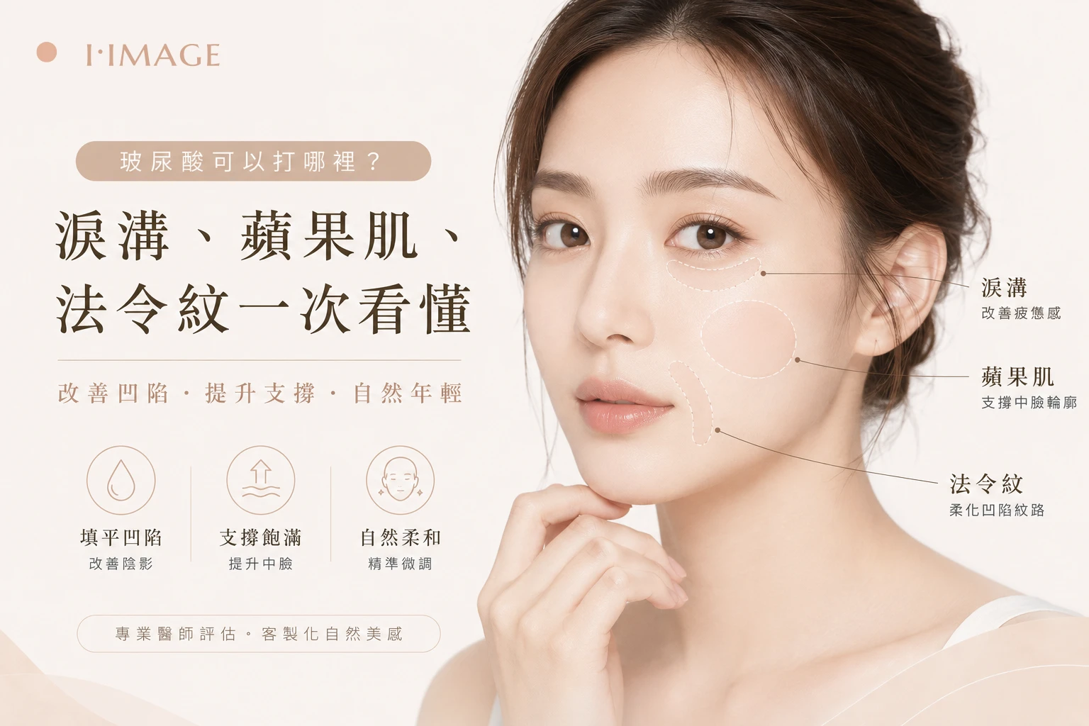 玻尿酸可以打哪裡-淚溝蘋果肌法令紋-台中依美琦