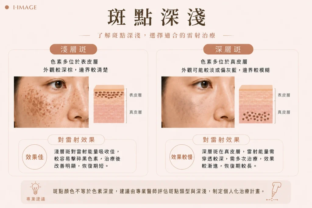 斑點深淺示意圖 :淺層斑深層斑影響雷射效果