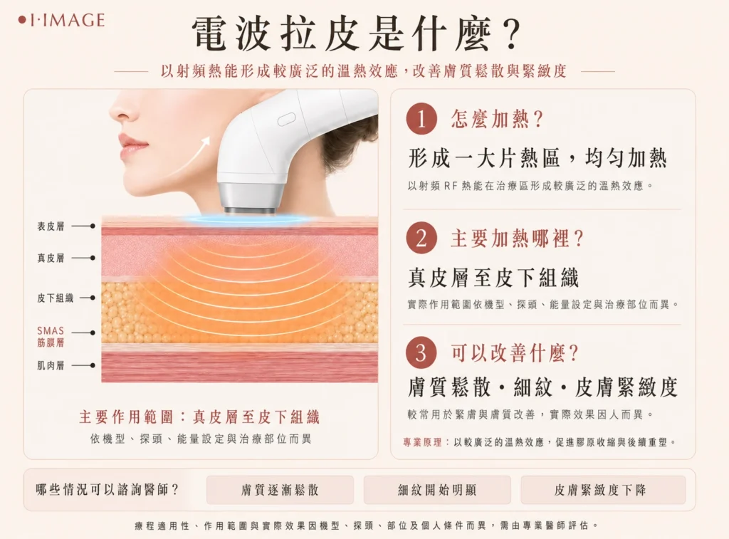 電波拉皮原理與作用層次示意圖，說明熱能均勻加熱皮下脂肪層至SMAS筋膜層