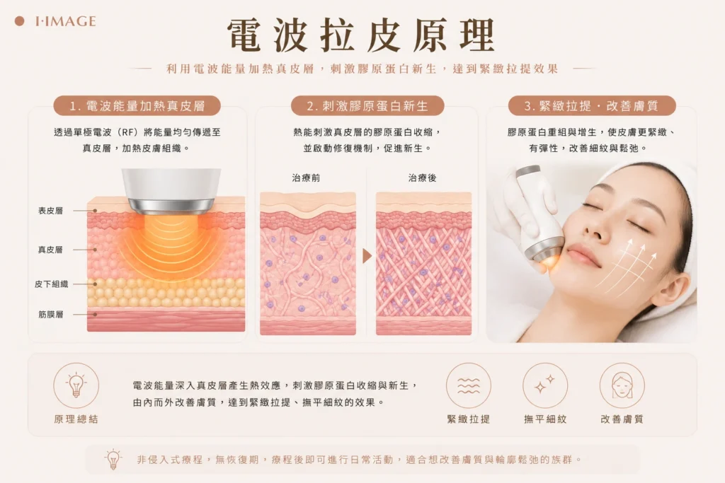 電波拉皮射頻容積式加熱真皮層緊膚
