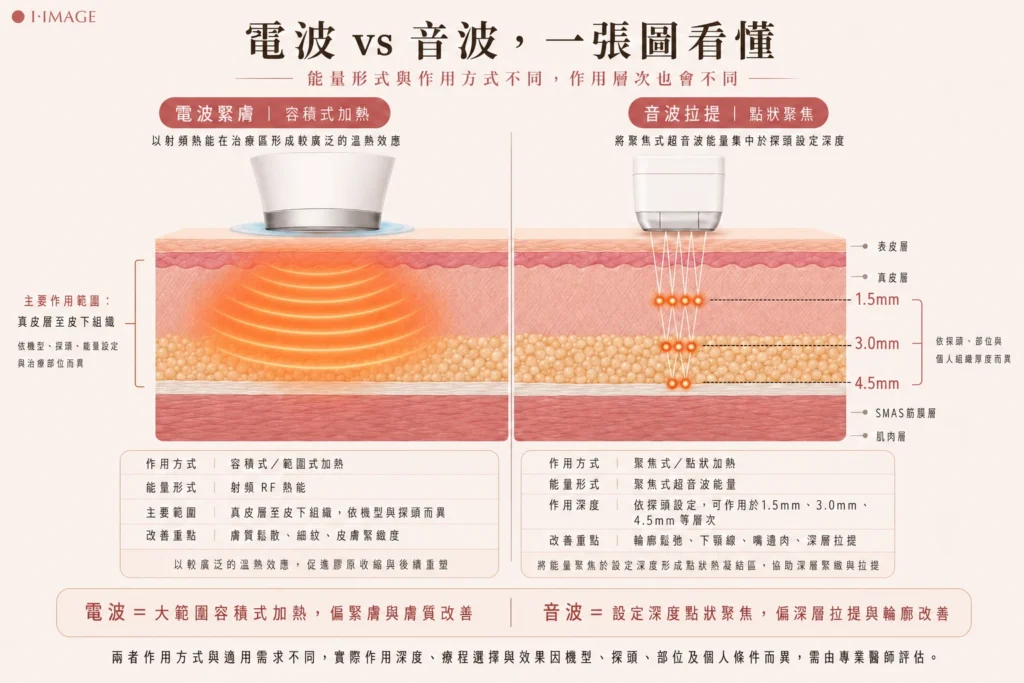電波緊膚與音波拉提作用層次差別