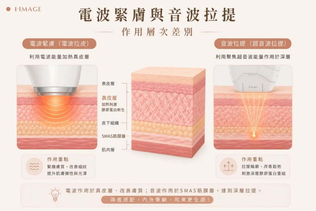 電波緊膚與音波拉提作用層次差別