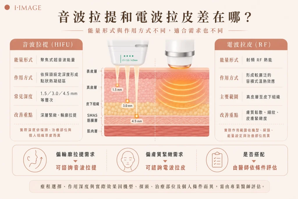 音波拉提和電波拉皮差別圖表