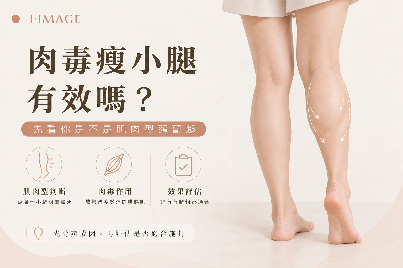肉毒瘦小腿改善肌肉型蘿蔔腿-台中依美琦
